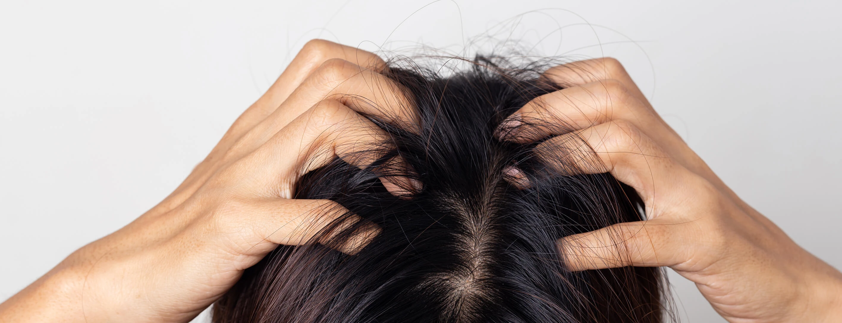 Болячки на коже головы: причины, лечение | Capillum Clinic