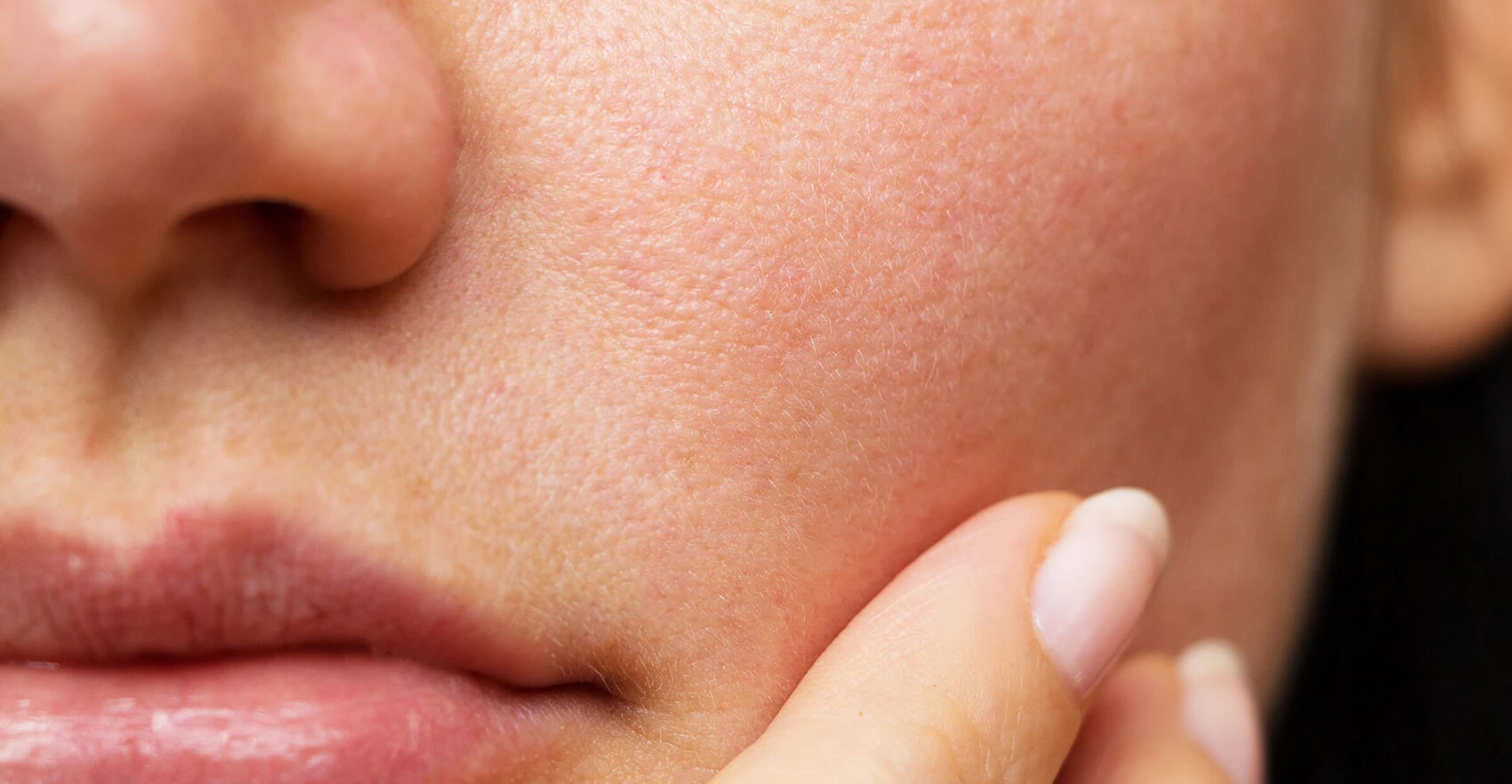 Что такое гиалуроновая кислота и чем полезна для кожи?