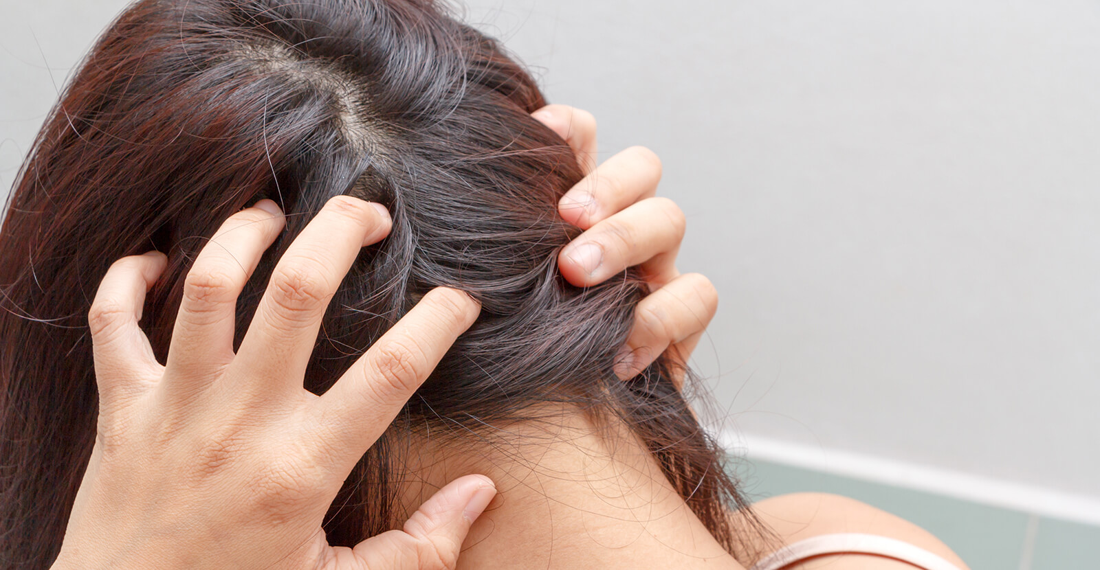 Сухая кожа головы – что делать? | Лечение и увлажнение очень ухой кожи головы в IHC